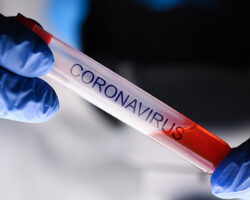 Immagine Il Vero Impatto del Coronavirus sull’Economia Italiana: l’allarme del Financial Times